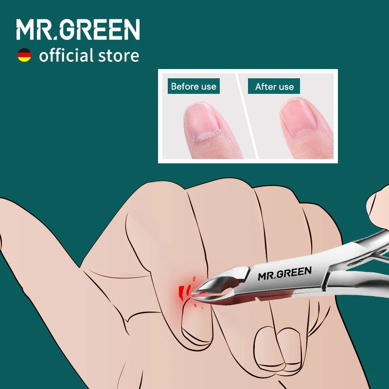 MR.GREEN Cuticle Nippers Nail Clippers Stainless Steel Tool