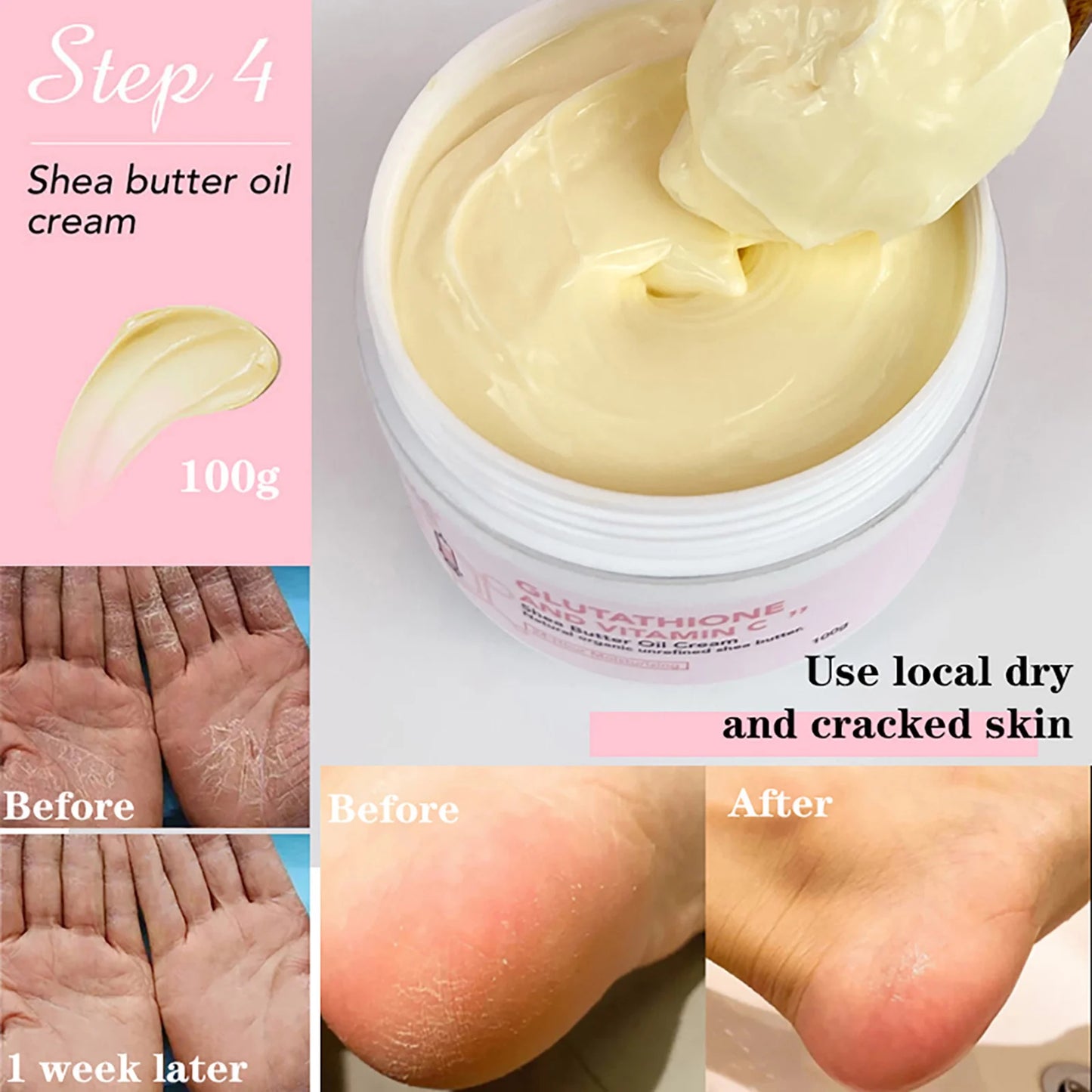 AILKE Whitening Facial Lotion With Vitamin C And Glutathione